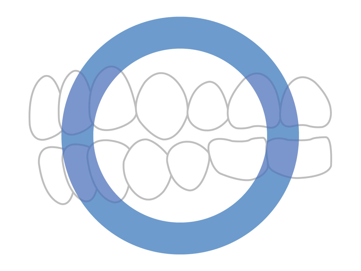 数ミリの間隔があり接触していません