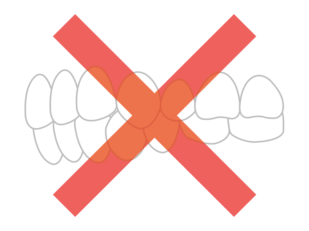 間隔がなく接触している