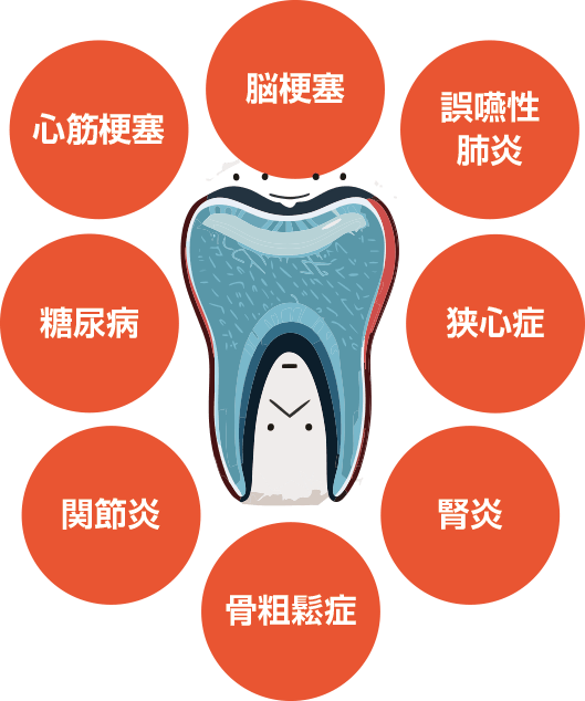 歯周病と全身疾患について