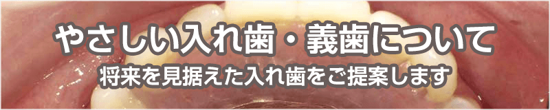 やさしい入れ歯・義歯について